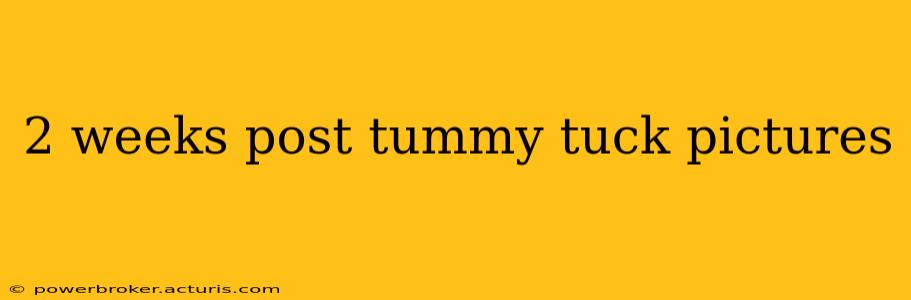 2 weeks post tummy tuck pictures