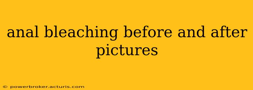 anal bleaching before and after pictures
