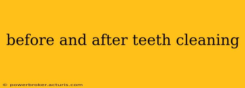 before and after teeth cleaning