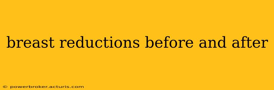breast reductions before and after