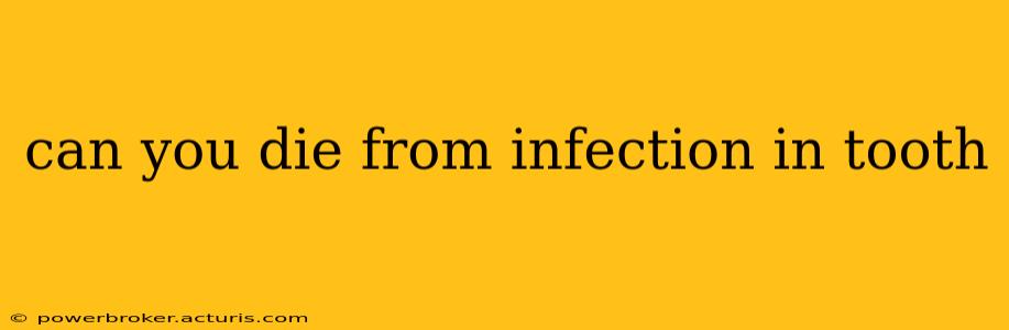 can you die from infection in tooth