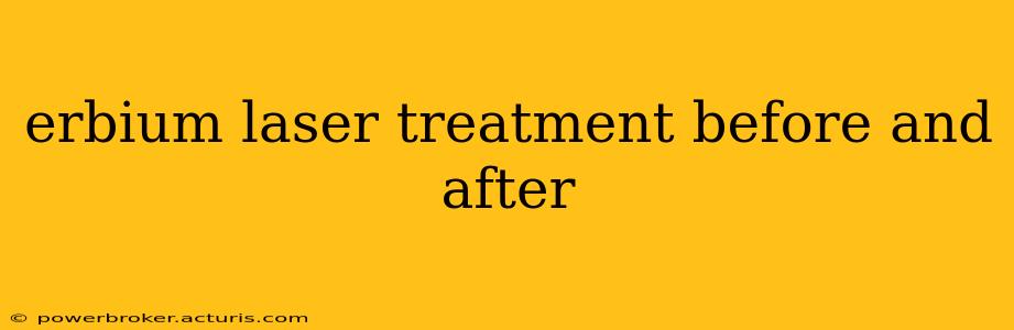erbium laser treatment before and after