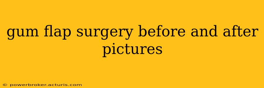 gum flap surgery before and after pictures