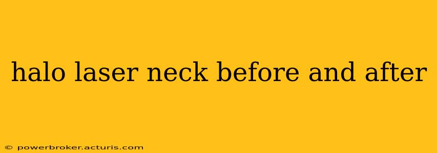 halo laser neck before and after