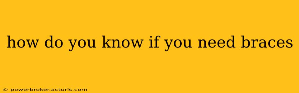how do you know if you need braces