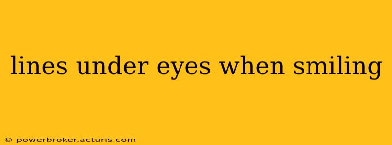 lines under eyes when smiling
