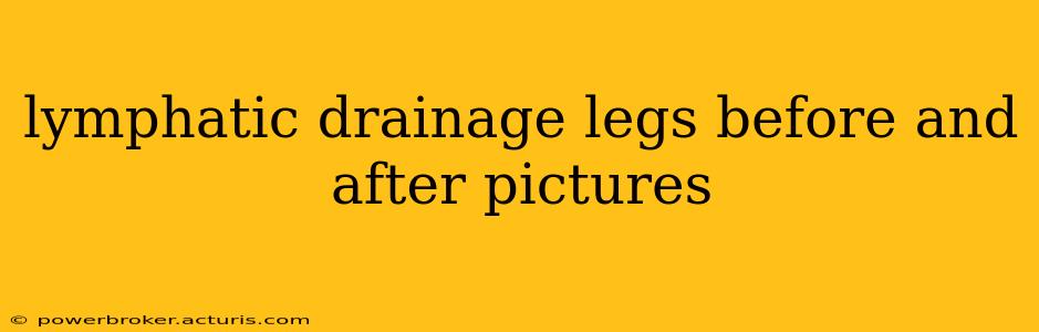 lymphatic drainage legs before and after pictures
