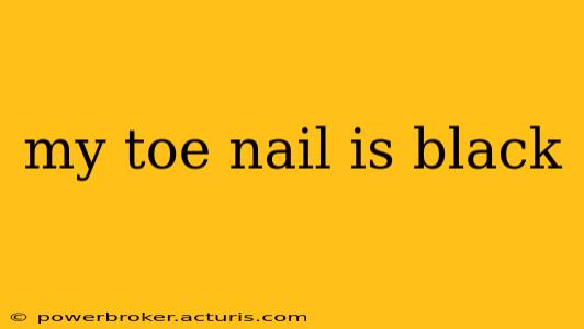 my toe nail is black