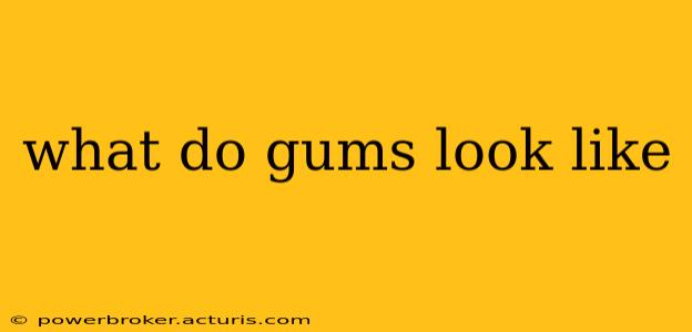 what do gums look like