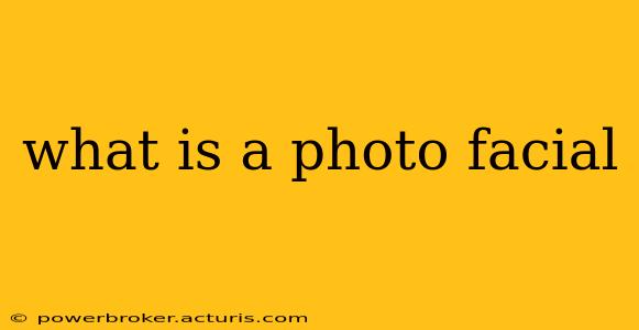 what is a photo facial