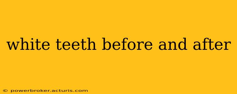 white teeth before and after